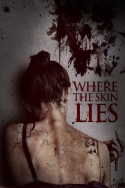 Watch Free Where the Skin Lies Movies Full HD Soaper TV