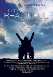 Watch Free More Beautiful for Having Been Broken Movies Full HD Soaper TV